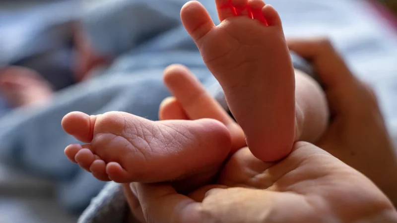 Wyzwania dermatologiczne u niemowląt